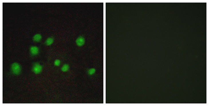 TCEB3B / Elongin A2 Antibody - Immunofluorescence analysis of A549 cells, using ELOA2 Antibody. The picture on the right is blocked with the synthesized peptide.