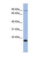 TCEB3B / Elongin A2 Antibody - TCEB3B antibody Western blot of OVCAR-3 cell lysate. This image was taken for the unconjugated form of this product. Other forms have not been tested.