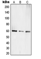 TCEB3C / Elongin A3 Antibody - Western blot analysis of TCEB3C expression in Jurkat (A); mouse kidney (B); rat kidney (C) whole cell lysates.