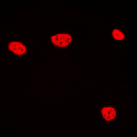 TCEB3C / Elongin A3 Antibody - Immunofluorescent analysis of TCEB3C staining in Jurkat cells. Formalin-fixed cells were permeabilized with 0.1% Triton X-100 in TBS for 5-10 minutes and blocked with 3% BSA-PBS for 30 minutes at room temperature. Cells were probed with the primary antibody in 3% BSA-PBS and incubated overnight at 4 C in a humidified chamber. Cells were washed with PBST and incubated with a DyLight 594-conjugated secondary antibody (red) in PBS at room temperature in the dark. DAPI was used to stain the cell nuclei (blue).