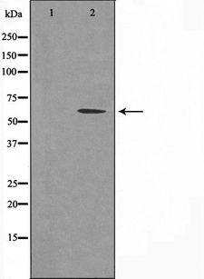 TCEB3C / Elongin A3 Antibody - Western blot analysis of extracts of COLO cells using ELOA3 antibody. The lane on the left is treated with the antigen-specific peptide.