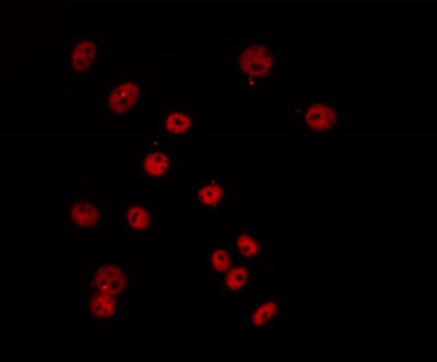 TCEB3C / Elongin A3 Antibody - Staining COLO205 cells by IF/ICC. The samples were fixed with PFA and permeabilized in 0.1% Triton X-100, then blocked in 10% serum for 45 min at 25°C. The primary antibody was diluted at 1:200 and incubated with the sample for 1 hour at 37°C. An Alexa Fluor 594 conjugated goat anti-rabbit IgG (H+L) Ab, diluted at 1/600, was used as the secondary antibody.