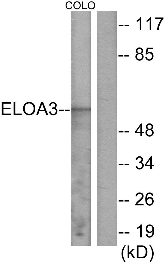 TCEB3C / Elongin A3 Antibody - Western blot analysis of extracts from COLO cells, using ELOA3 antibody.