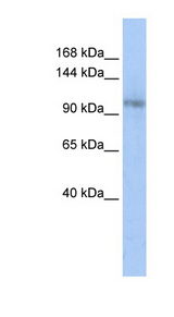 TCERG1 / CA150 Antibody - TCERG1 antibody Western blot of Jurkat lysate. This image was taken for the unconjugated form of this product. Other forms have not been tested.