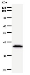 TCERG1 / CA150 Antibody - Western blot of immunized recombinant protein using TCERG1 antibody.