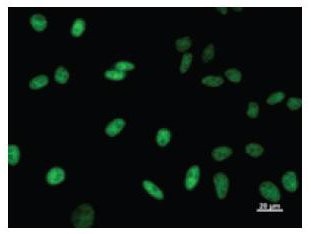 TCERG1 / CA150 Antibody - Immunofluorescent staining using TCERG1 antibody. Immunostaining analysis in HeLa cells. HeLa cells were fixed with 4% paraformaldehyde and permeabilized with 0.01% Triton-X100 in PBS. The cells were immunostained with anti-TCERG1 antibody.