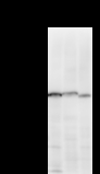 TCERG1 / CA150 Antibody - Detection of TCERG1 by Western blot. Samples: Whole cell lysate from human A2058 (H, 50 ug) , mouse NIH3T3 (M, 50 ug) and rat F2408 (R, 50 ug) cells. Predicted molecular weight: 123 kDa