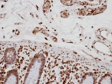 TCERG1 / CA150 Antibody - IHC of paraffin-embedded Colon, using CA150 antibody at 1:250 dilution.