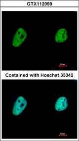 TCERG1 / CA150 Antibody - Immunofluorescence of paraformaldehyde-fixed HeLa, using CA150 antibody at 1:500 dilution.