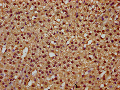 TCERG1 / CA150 Antibody - Immunohistochemistry Dilution at 1:300 and staining in paraffin-embedded human adrenal gland tissue performed on a Leica BondTM system. After dewaxing and hydration, antigen retrieval was mediated by high pressure in a citrate buffer (pH 6.0). Section was blocked with 10% normal Goat serum 30min at RT. Then primary antibody (1% BSA) was incubated at 4°C overnight. The primary is detected by a biotinylated Secondary antibody and visualized using an HRP conjugated SP system.
