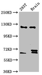 TCERG1 / CA150 Antibody - Western Blot Positive WB detected in: 293T whole cell lysate, Rat brain tissue All Lanes: TCERG1 antibody at 5.9µg/ml Secondary Goat polyclonal to rabbit IgG at 1/50000 dilution Predicted band size: 124, 122 KDa Observed band size: 124 KDa