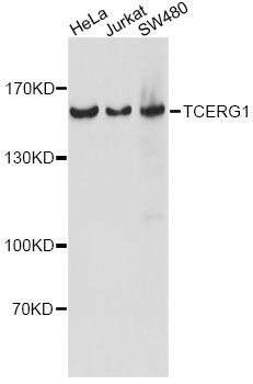 TCERG1 / CA150 Antibody - Western blot analysis of extracts of various cell lines, using TCERG1 antibody at 1:1000 dilution. The secondary antibody used was an HRP Goat Anti-Rabbit IgG (H+L) at 1:10000 dilution. Lysates were loaded 25ug per lane and 3% nonfat dry milk in TBST was used for blocking. An ECL Kit was used for detection and the exposure time was 5s.