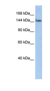 TCERG1 / CA150 Antibody - TCERG1 antibody Western blot of HepG2 cell lysate. This image was taken for the unconjugated form of this product. Other forms have not been tested.