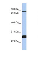 TCF11 / NFE2L1 Antibody - NFE2L1 antibody Western blot of 1 Cell lysate. Antibody concentration 1 ug/ml.  This image was taken for the unconjugated form of this product. Other forms have not been tested.