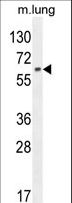 TCF11 / NFE2L1 Antibody - NFE2L1 Antibody western blot of mouse lung tissue lysates (35 ug/lane). The NFE2L1 antibody detected the NFE2L1 protein (arrow).