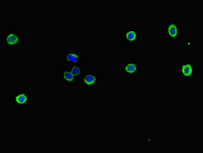 TCF11 / NFE2L1 Antibody - Immunofluorescent analysis of HepG2 cells using NFE2L1 Antibody at dilution of 1:100 and Alexa Fluor 488-congugated AffiniPure Goat Anti-Rabbit IgG(H+L)