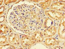 TCF11 / NFE2L1 Antibody - Immunohistochemistry of paraffin-embedded human renal tissue using NFE2L1 Antibody at dilution of 1:100