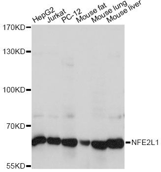 TCF11 / NFE2L1 Antibody - Western blot analysis of extracts of various cell lines, using NFE2L1 antibody at 1:1000 dilution. The secondary antibody used was an HRP Goat Anti-Rabbit IgG (H+L) at 1:10000 dilution. Lysates were loaded 25ug per lane and 3% nonfat dry milk in TBST was used for blocking. An ECL Kit was used for detection and the exposure time was 1s.