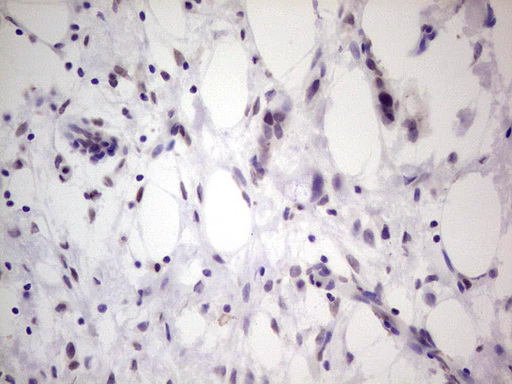 TCF12 / HEB Antibody - Immunohistochemical staining of paraffin-embedded Human lymph node tissue within the normal limits using anti-TCF12 mouse monoclonal antibody. (Heat-induced epitope retrieval by 1 mM EDTA in 10mM Tris, pH8.5, 120C for 3min,