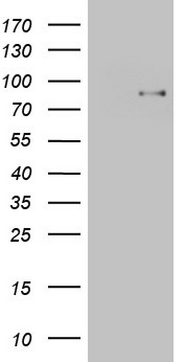 TCF12 / HEB Antibody - HEK293T cells were transfected with the pCMV6-ENTRY control (Left lane) or pCMV6-ENTRY TCF12 (Right lane) cDNA for 48 hrs and lysed. Equivalent amounts of cell lysates (5 ug per lane) were separated by SDS-PAGE and immunoblotted with anti-TCF12.
