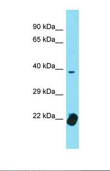 TCF12 / HEB Antibody - Western blot of Human Uterus Tumor. TCF12 antibody dilution 1.0 ug/ml.  This image was taken for the unconjugated form of this product. Other forms have not been tested.