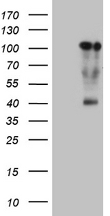 TCF12 / HEB Antibody - HEK293T cells were transfected with the pCMV6-ENTRY control. (Left lane) or pCMV6-ENTRY TCF12. (Right lane) cDNA for 48 hrs and lysed. Equivalent amounts of cell lysates. (5 ug per lane) were separated by SDS-PAGE and immunoblotted with anti-TCF12. (1:2000)