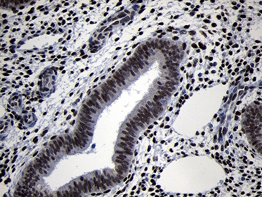 TCF12 / HEB Antibody - Immunohistochemical staining of paraffin-embedded Human endometrium tissue within the normal limits using anti-TCF12 mouse monoclonal antibody. (Heat-induced epitope retrieval by 1mM EDTA in 10mM Tris buffer. (pH8.5) at 120°C for 3 min. (1:1000)