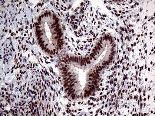 TCF12 / HEB Antibody - Immunohistochemical staining of paraffin-embedded Human endometrium tissue within the normal limits using anti-TCF12 mouse monoclonal antibody. (Heat-induced epitope retrieval by 1mM EDTA in 10mM Tris buffer. (pH8.5) at 120°C for 3 min. (1:500)