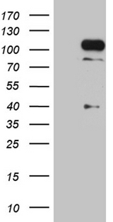 TCF12 / HEB Antibody - HEK293T cells were transfected with the pCMV6-ENTRY control. (Left lane) or pCMV6-ENTRY TCF12. (Right lane) cDNA for 48 hrs and lysed