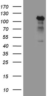 TCF12 / HEB Antibody - HEK293T cells were transfected with the pCMV6-ENTRY control. (Left lane) or pCMV6-ENTRY TCF12. (Right lane) cDNA for 48 hrs and lysed