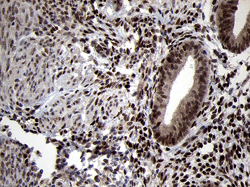 TCF12 / HEB Antibody - Immunohistochemical staining of paraffin-embedded Human endometrium tissue within the normal limits using anti-TCF12 mouse monoclonal antibody. (Heat-induced epitope retrieval by 1mM EDTA in 10mM Tris buffer. (pH8.5) at 120°C for 3 min. (1:500)
