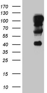 TCF12 / HEB Antibody - HEK293T cells were transfected with the pCMV6-ENTRY control. (Left lane) or pCMV6-ENTRY TCF12. (Right lane) cDNA for 48 hrs and lysed. Equivalent amounts of cell lysates. (5 ug per lane) were separated by SDS-PAGE and immunoblotted with anti-TCF12. (1:2000)