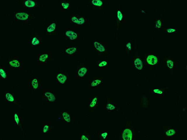 TCF12 / HEB Antibody - Immunofluorescence staining of TCF12 in HeLa cells. Cells were fixed with 4% PFA, permeabilzed with 0.1% Triton X-100 in PBS, blocked with 10% serum, and incubated with rabbit anti-Human TCF12 polyclonal antibody (dilution ratio 1:1000) at 4°C overnight. Then cells were stained with the Alexa Fluor 488-conjugated Goat Anti-rabbit IgG secondary antibody (green).