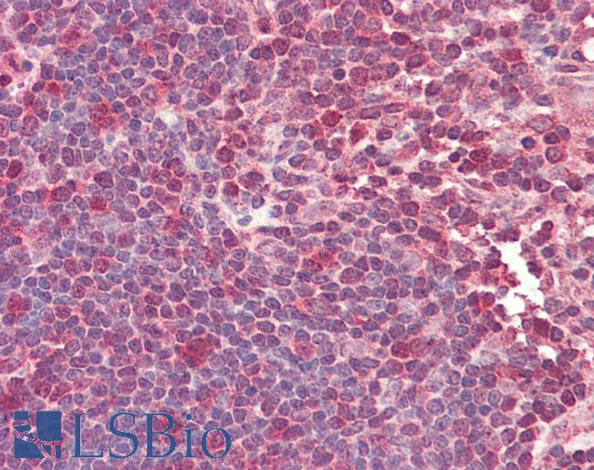 TCF12 / HEB Antibody - Anti-TCF12 / HEB antibody IHC staining of human thymus. Immunohistochemistry of formalin-fixed, paraffin-embedded tissue after heat-induced antigen retrieval. Antibody concentration 5 ug/ml.  This image was taken for the unconjugated form of this product. Other forms have not been tested.