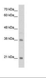 TCF15 / PARAXIS Antibody - Jurkat Cell Lysate.  This image was taken for the unconjugated form of this product. Other forms have not been tested.