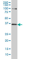 TCF19 / TCF-19 Antibody - TCF19 monoclonal antibody (M01), clone 6D8 Western blot of TCF19 expression in HeLa NE.