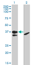 TCF19 / TCF-19 Antibody - Western blot of TCF19 expression in transfected 293T cell line by TCF19 monoclonal antibody (M01), clone 6D8.