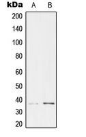 TCF19 / TCF-19 Antibody - Western blot analysis of TCF19 expression in HeLa (A); HEK293 (B) whole cell lysates.