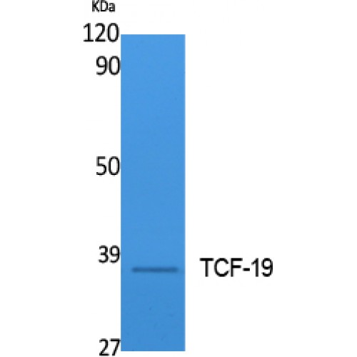 TCF19 / TCF-19 Antibody - Western blot of TCF-19 antibody