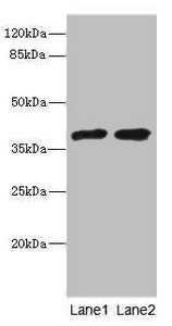 TCF19 / TCF-19 Antibody - Western blot All Lanes:TCF19 antibody at 0.96ug/ml Lane 1:293T whole cell lysate Lane 2:Rat thymus tissue Secondary Goat polyclonal to rabbit at 1/10000 dilution Predicted band size: 37kDa Observed band size: 37kDa