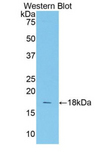 TCF20 Antibody - Western blot of recombinant TCF20.  This image was taken for the unconjugated form of this product. Other forms have not been tested.