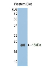 TCF20 Antibody - Western blot of recombinant TCF20.  This image was taken for the unconjugated form of this product. Other forms have not been tested.