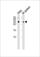 TCF21 / Epicardin Antibody - Western blot of lysates from HeLa cell line mouse spleen tissue lysate(from left to right), using TCF21 Antibody. Antibody was diluted at 1:1000 at each lane. A goat anti-rabbit IgG H&L (HRP) at 1:5000 dilution was used as the secondary antibody. Lysates at 35ug per lane.