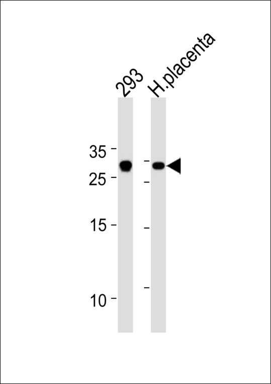 TCF21 / Epicardin Antibody - TCF21 Antibody western blot of 293 cell line and human placenta tissue lysates (35 ug/lane). The TCF21 antibody detected the TCF21 protein (arrow).