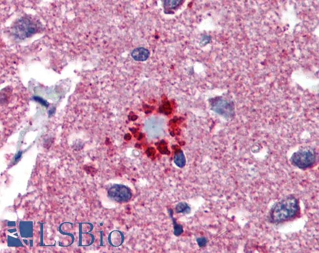 TCF21 / Epicardin Antibody - Anti-TCF21 antibody IHC of human brain, cortex, senile plaque. Immunohistochemistry of formalin-fixed, paraffin-embedded tissue after heat-induced antigen retrieval. Antibody concentration 5 ug/ml.  This image was taken for the unconjugated form of this product. Other forms have not been tested.