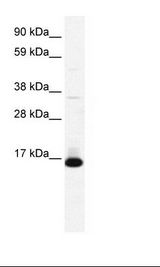 TCF21 / Epicardin Antibody - Fetal Lung Lysate.  This image was taken for the unconjugated form of this product. Other forms have not been tested.