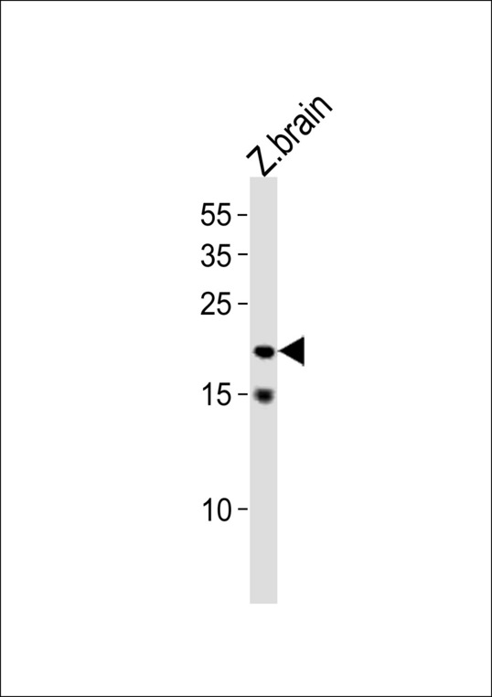 TCF21 / Epicardin Antibody - DANRE tcf21 Antibody western blot of zebra fish brain tissue lysates (35 ug/lane). The DANRE tcf21 antibody detected the DANRE tcf21 protein (arrow).