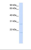 TCF21 / Epicardin Antibody - Transfected 293T cell lysate. Antibody concentration: 1.0 ug/ml. Gel concentration: 12%.  This image was taken for the unconjugated form of this product. Other forms have not been tested.