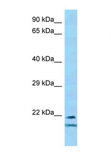 TCF23 Antibody - TCF23 antibody Western blot of Mouse Spleen lysate. Antibody concentration 1 ug/ml.  This image was taken for the unconjugated form of this product. Other forms have not been tested.