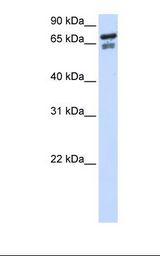 TCF25 Antibody - Transfected 293T cell lysate. Antibody concentration: 1.0 ug/ml. Gel concentration: 12%.  This image was taken for the unconjugated form of this product. Other forms have not been tested.